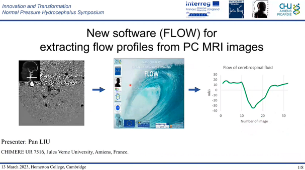 New software for extracting flow profiles from PC MRI images